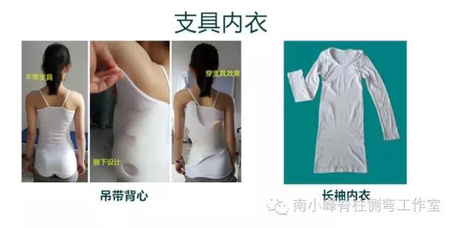穿戴支具时的内衣选择 侧弯支具相关文章 第2张