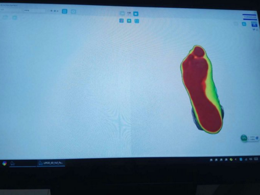全国5家工作室都可以开始3D足部检测和鞋垫定制 侧弯支具相关文章 第4张