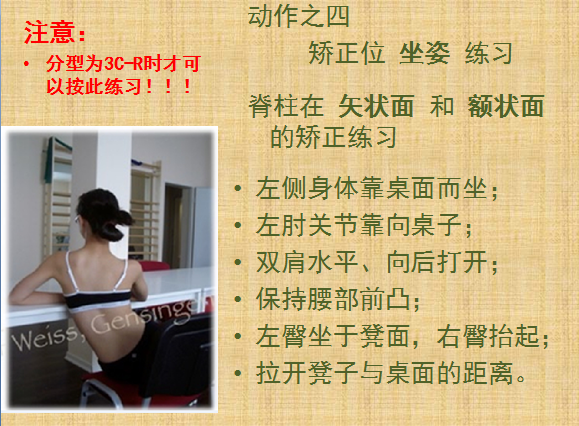 施罗斯脊柱侧弯矫形体操3CR分型基础动作之四矫正位坐姿练习 矫形体操相关文章 第1张