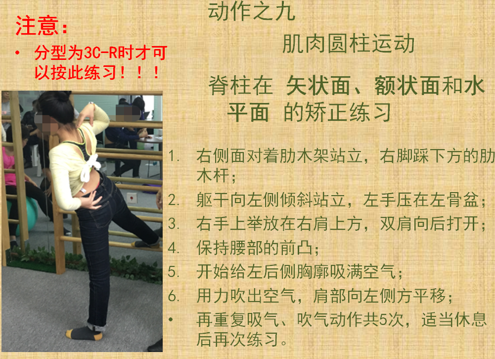 施罗斯脊柱侧弯矫形体操基础动作之九肌肉圆柱运动 矫形体操相关文章 第1张