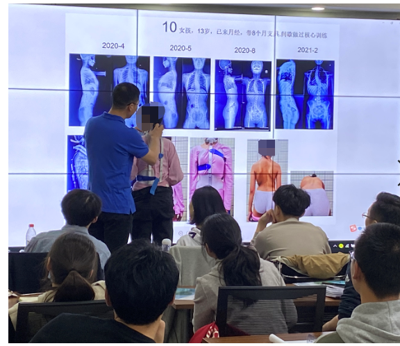 脊柱侧弯保守治疗还需努力-施罗斯SBP治疗师培训郑州班 团队动态 第1张