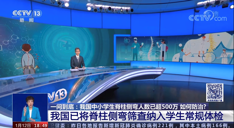 中小学脊柱侧弯有500万-央视新闻报道 侧弯支具相关文章 第4张