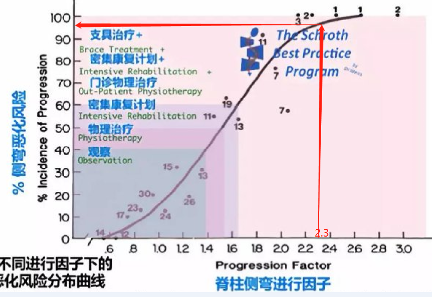 GBW支具矫正案例20220625    GBW脊柱侧弯支具矫正案例 第1张